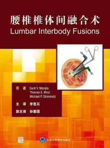 腰椎椎体间融合术