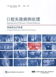 口腔失败病例处理 种植再治疗图谱