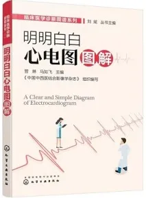 明明白白心电图图解