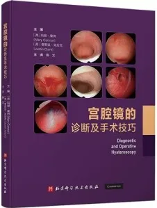 宫腔镜的诊断及手术技巧