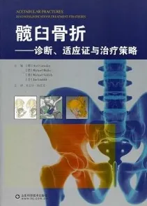 髋臼骨折 诊断、适应证与治疗策略