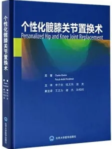 个性化髋膝关节置换术
