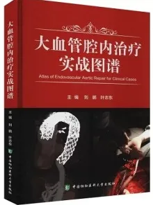 大血管腔内治疗实战图谱