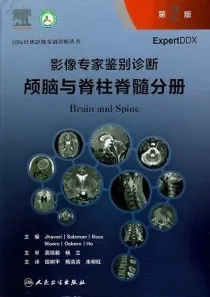 影像专家鉴别诊断 颅脑与脊柱脊髓分册 第2版