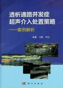 透析通路并发症超声介入处理策略 案例解析