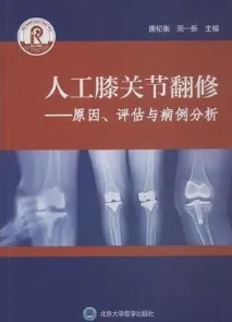 人工膝关节翻修 原因、评估与病例分析