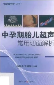中孕期胎儿超声常用切面解析