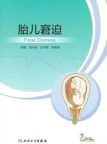 胎儿窘迫