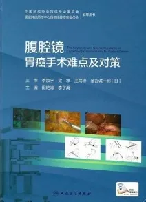 腹腔镜胃癌手术难点及对策