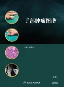 手部肿瘤图谱