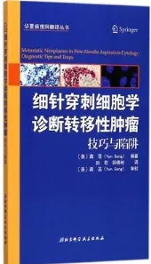 细针穿刺细胞学诊断转移性肿瘤 技巧与陷阱