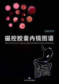 磁控胶囊内镜图谱