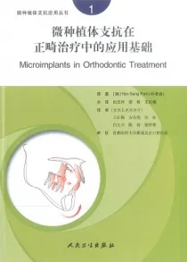 微种植体支抗在正畸治疗中的应用基础