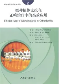 微种植体支抗在正畸治疗中的高效应用