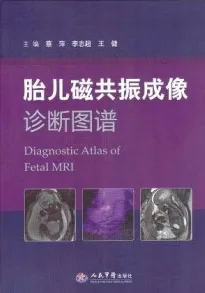 胎儿磁共振成像诊断图谱