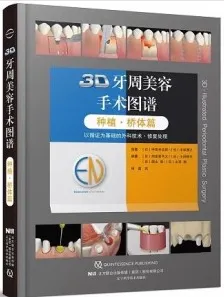 3D牙周美容手术图谱 种植•桥体篇