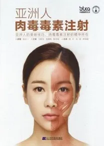 亚洲人肉毒毒素注射