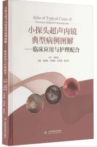 小探头超声内镜经典病例图解 临床应用与护理配合