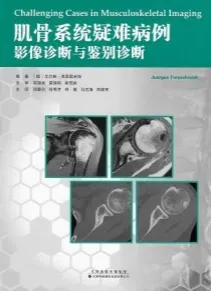 肌骨系统疑难病例影像诊断与鉴别诊断
