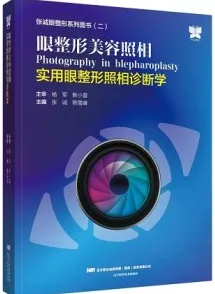 眼整形美容照相 实用眼整形照相诊断学