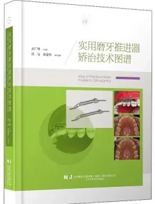 实用磨牙推进器矫治技术图谱