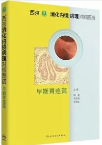 西京消化内镜病理对照图谱 早期胃癌篇
