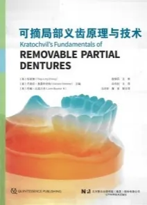可摘局部义齿原理与技术