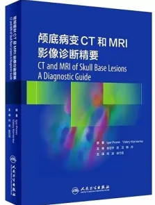 颅底病变CT和MRI影像诊断精要