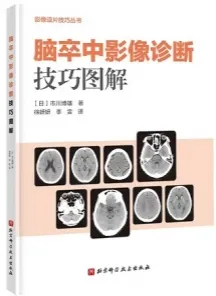 脑卒中影像诊断技巧图