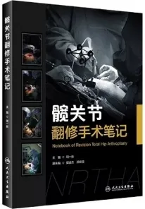髋关节翻修手术笔记