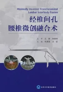 经椎间孔腰椎微创融合术