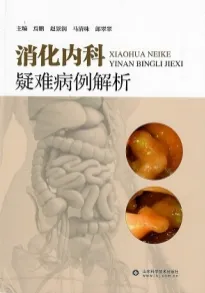 消化内科疑难病例解析