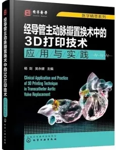 经导管主动脉瓣置换术中的3D打印技术应用与实践