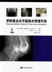 罗斯曼全关节置换术管理手册