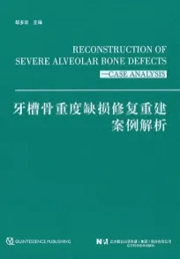 牙槽骨重度缺损修复重建案例解析