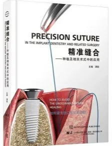 精准缝合 种植及相关术式中的应用