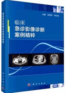 临床急诊影像诊断案例精粹