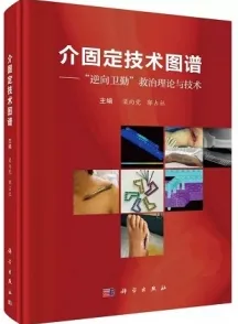 介固定技术图谱