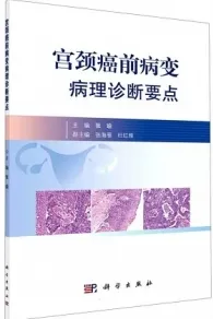 宫颈癌前病变病理诊断要点