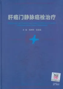 肝癌门静脉癌栓治疗