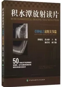 积水潭放射读片 骨肿瘤之肩肘关节篇