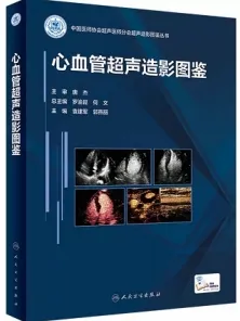 心血管超声造影图鉴