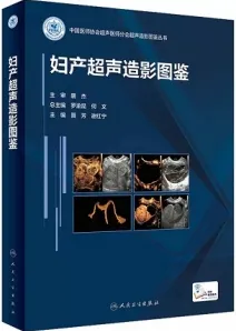 妇产超声造影图鉴