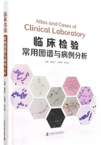 临床检验常用图谱与病例分析