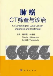 肺癌CT筛查与诊治