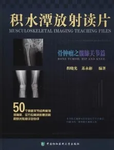 积水潭放射读片 骨肿瘤之髋膝关节篇