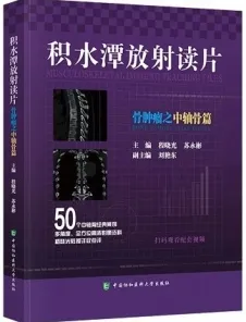 积水潭放射读片 骨肿瘤之中轴骨篇