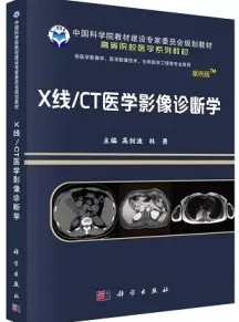 X线 CT医学影像诊断学 案例版