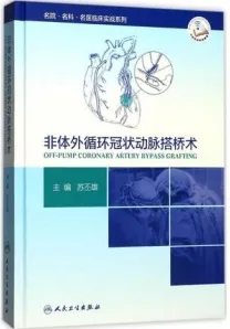 非体外循环冠状动脉搭桥术