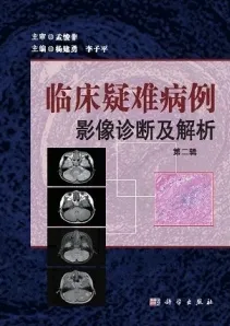 临床疑难病例影像诊断及解析 第二辑